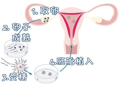 代生供卵公司